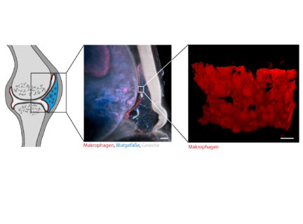 Towards entry "Macrophage barrier controls inflammation"